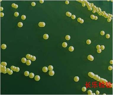 醫(yī)藥行業(yè)：人體存有金黃色葡萄球菌為正?，F(xiàn)象